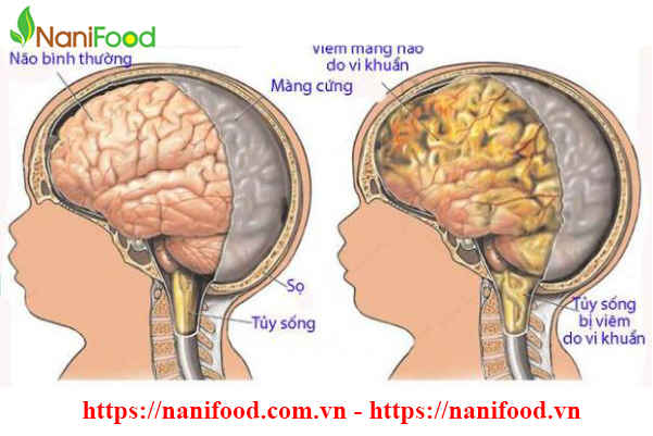 Vấn đề sức khỏe trẻ thường gặp phải mùa vào hè