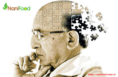 Dấu hiệu để nhận biết bệnh Alzheimer